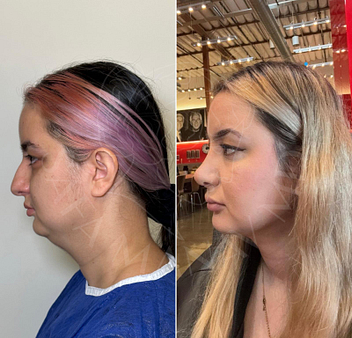 WhatsApp Image 2024-02-21 at 23.00.20