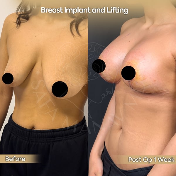 lifting6
