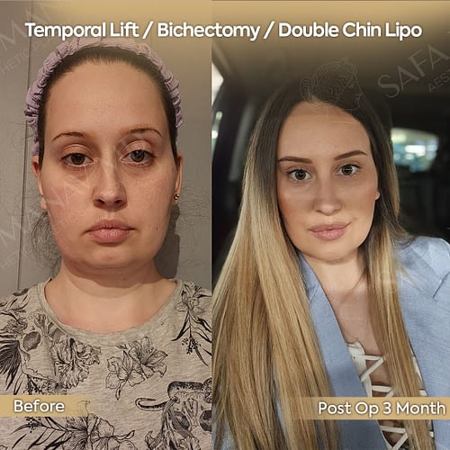 3monthba-kopya