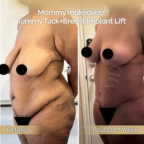 mommy111