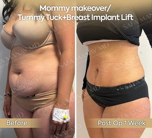 mommy2