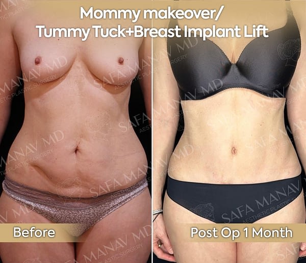 mommy3