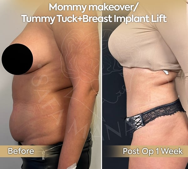 mommy1