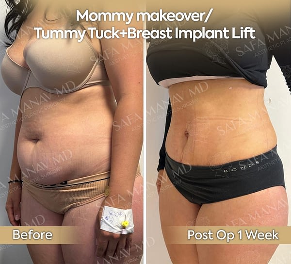 mommy2