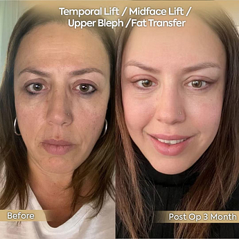 mogavkpgb8sk73xkrxcb